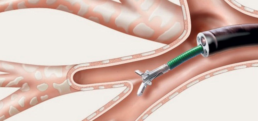Respiratory Endoscopy & Critical Care Solution