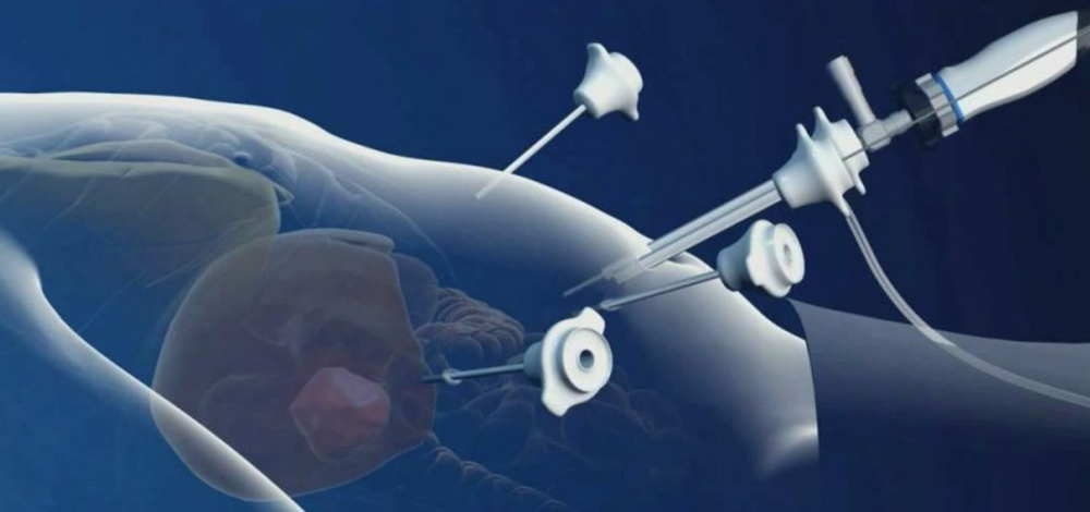 Minimally Invasive Surgery (General/Gynecology) Center Solution