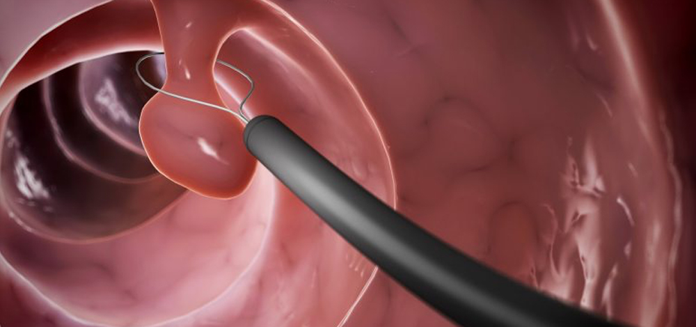 Complete GI Endoscopy Center Solution