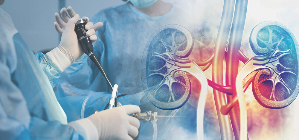 Minimally Invasive Urology Integrated Care Solution